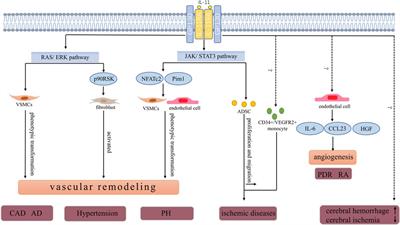 Roles and mechanism of IL-11 in vascular diseases